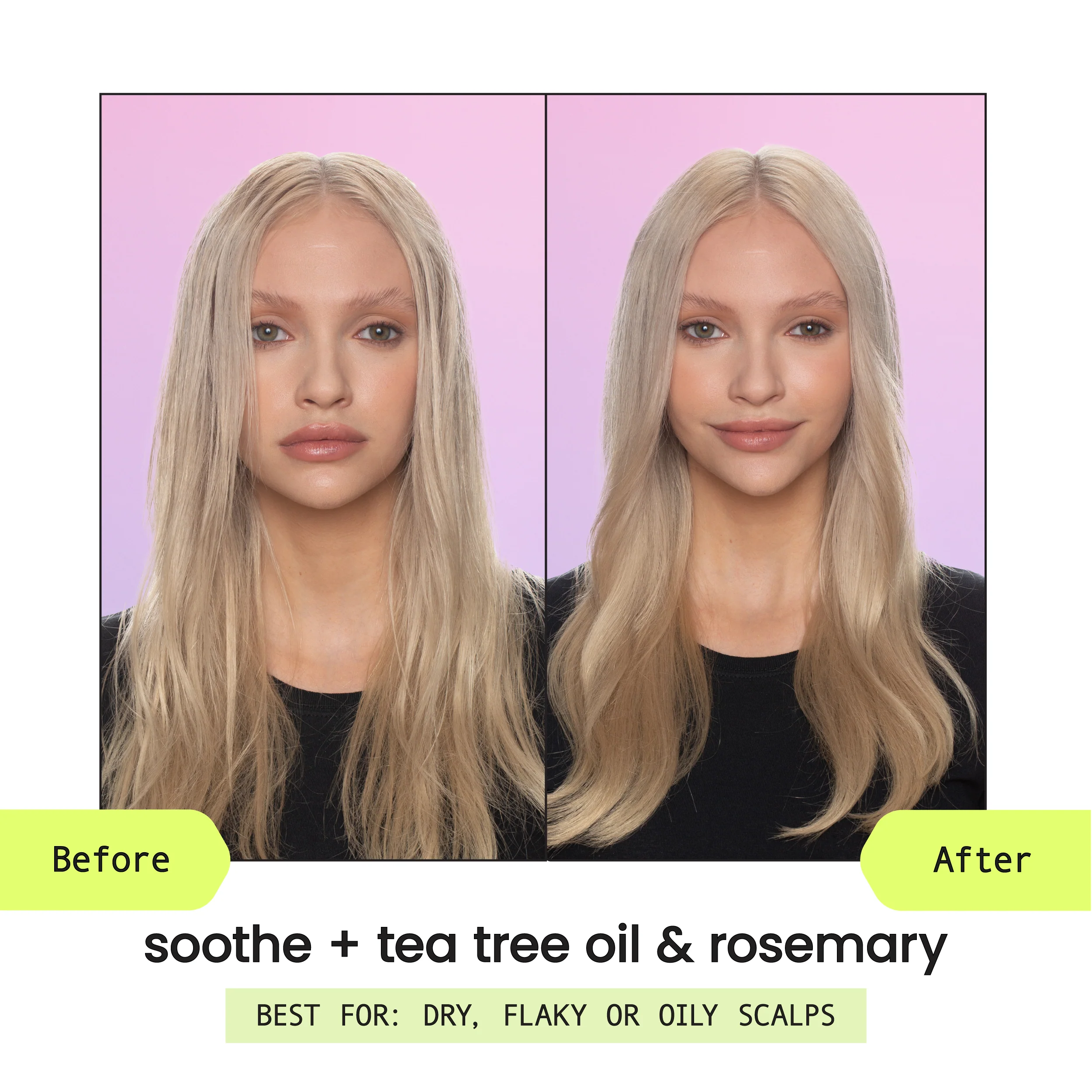Soothe + Tea Tree Oil & Rosemary 5-in-1 Leave-In Spray - Image 4